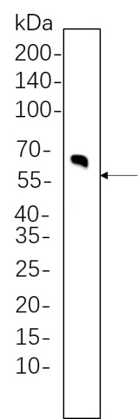 Recombinant Tyrosine Hydroxylase Monoclonal Antibody (AN301298L)