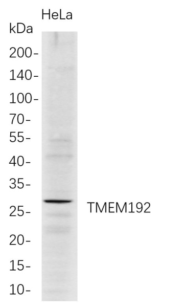 Recombinant TMEM192 Monoclonal Antibody (AN300761L)
