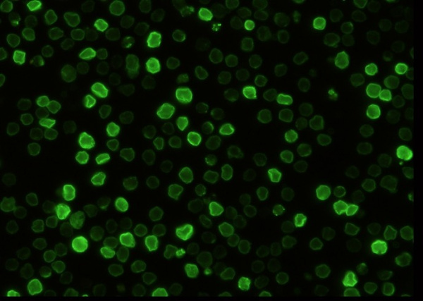 Recombinant CD147/EMMPRIN/Basigin Monoclonal Antibody (AN300510P)