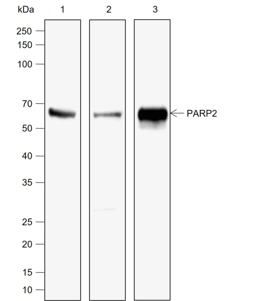 Recombinant PARP2 Monoclonal Antibody (AN302063L)