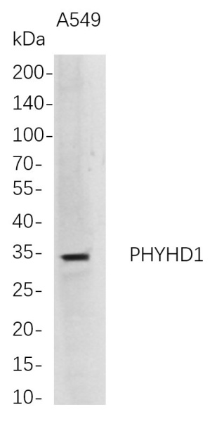 Recombinant PHYHD1 Monoclonal Antibody (AN300755L)