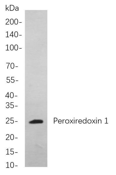 Recombinant Peroxiredoxin 1 Monoclonal Antibody (AN300967L)