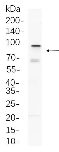 Recombinant EZH2 Monoclonal Antibody (AN300717L)