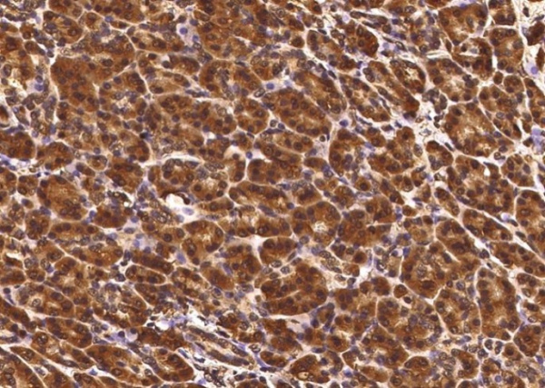 TCERG1L Monoclonal Antibody (AN200092P)