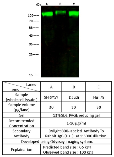 Recombinant CD166/ALCAM Monoclonal Antibody (AN300586P)
