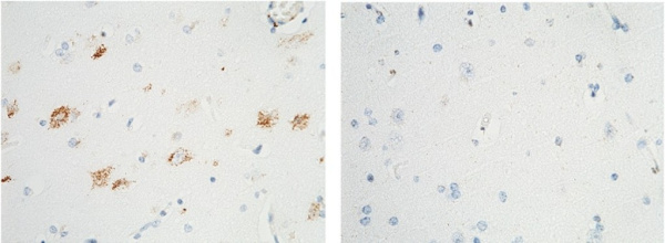 Recombinant TrkA/NTRK1 Monoclonal Antibody (AN300218P)
