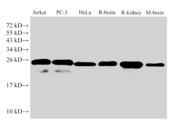GSTp1 Polyclonal Antibody (E-AB-40417)