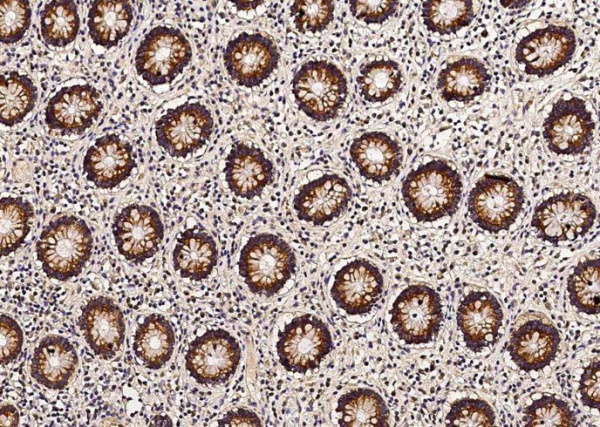Recombinant Thioredoxin-2/TXN2 Monoclonal Antibody (AN300425P)