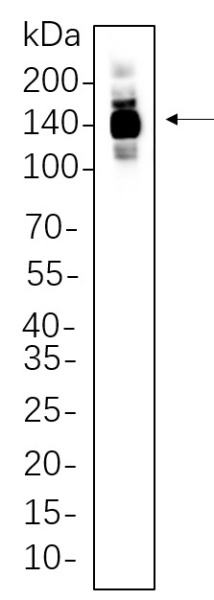Recombinant HDAC4 Monoclonal Antibody (AN300809L)