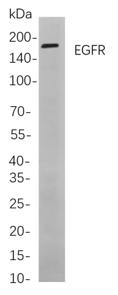 Recombinant EGFR Monoclonal Antibody (AN300843L)
