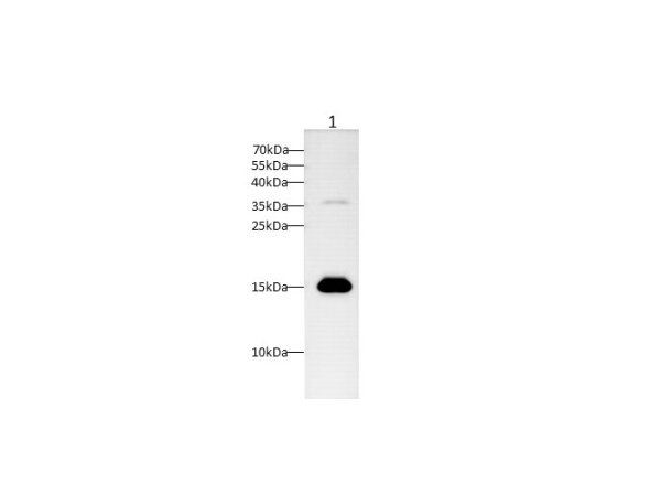 TTR Polyclonal Antibody (D-AB-10390L)