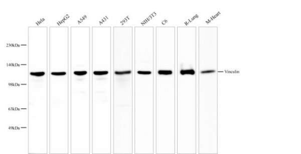 Vinculin Monoclonal Antibody (AN005300L)