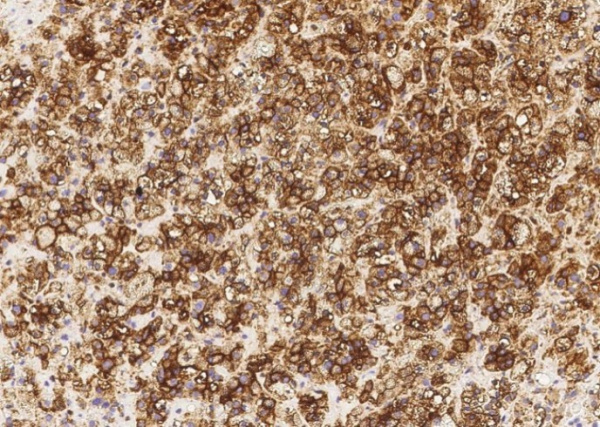 Recombinant Alkaline Phosphatase/ALPL Monoclonal Antibody (AN300088P)