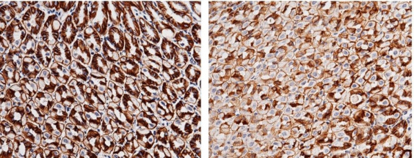 Recombinant Carbonic Anhydrase IX/Car9 Monoclonal Antibody (AN300542P)