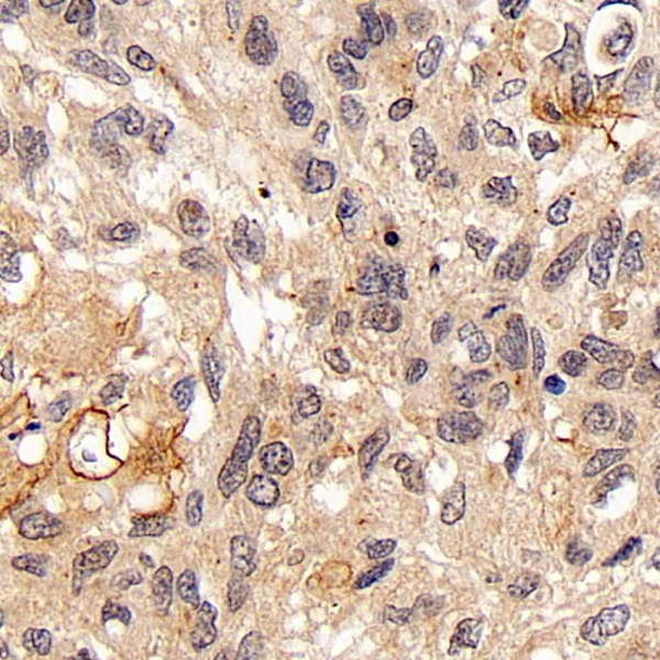 FOXO1 Polyclonal Antibody (E-AB-70144)