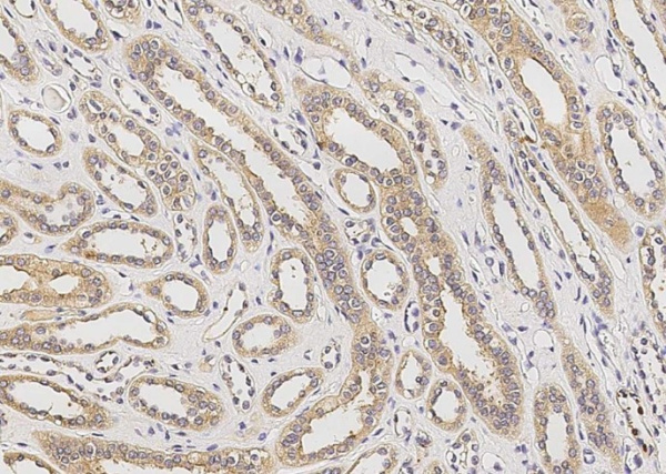 RAGE/AGER Monoclonal Antibody (AN200214P)
