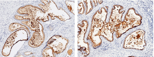 Recombinant KLK3/Kallikrein 3 Monoclonal Antibody (AN300053P)