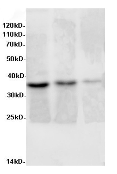 AIMP2 Polyclonal Antibody (E-AB-40046)