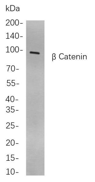 Recombinant β Catenin Monoclonal Antibody (AN300903L)