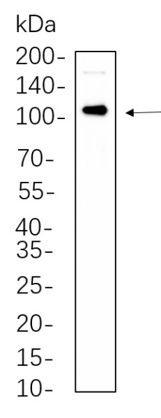 Recombinant Androgen Receptor Monoclonal Antibody (AN300627L)