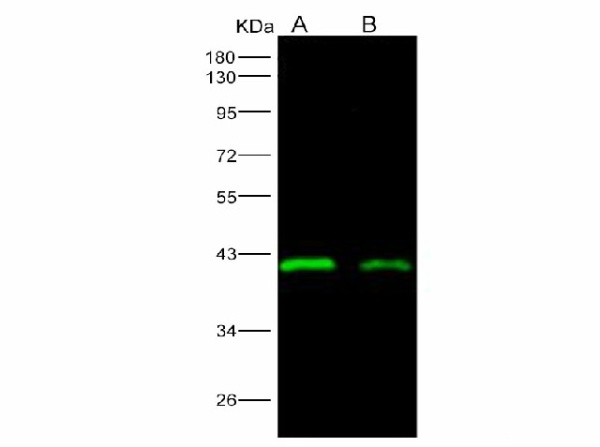 Anti-Ebola virus EBOV(subtype Sudan, strain Gulu) VP40/Matrix protein VP40 Monoclonal Antibody (E-AB-V1114)