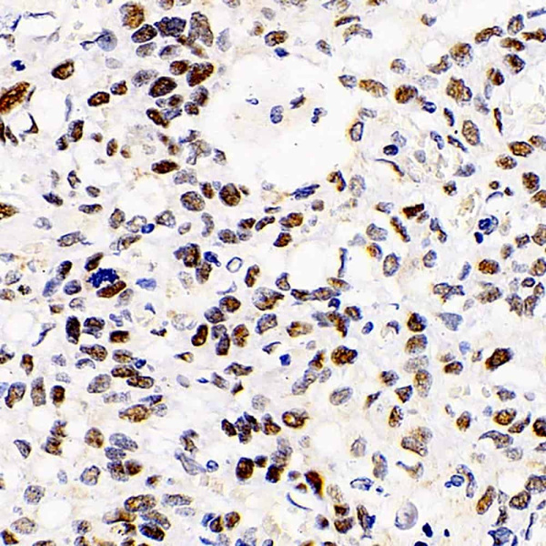 HDAC2 Polyclonal Antibody (E-AB-70243)