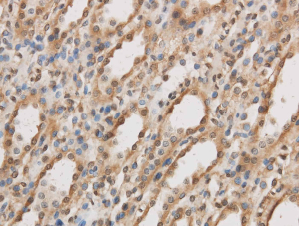 IL10RB Polyclonal Antibody (E-AB-40154)