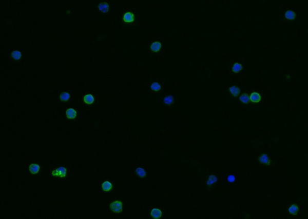 Recombinant CD23/FCER2 Monoclonal Antibody (AN300547P)