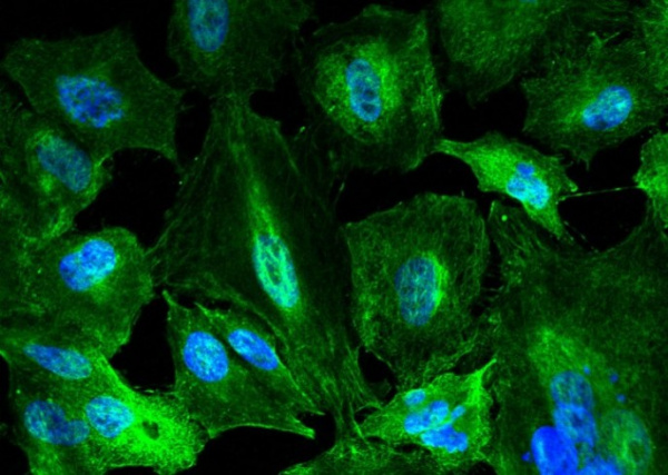 Recombinant KYNU Monoclonal Antibody (AN300078P)
