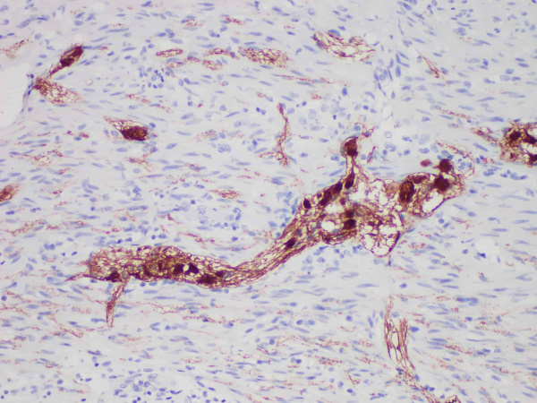 Calretinin （CR） Monoclonal Antibody (ELAB6569-M)