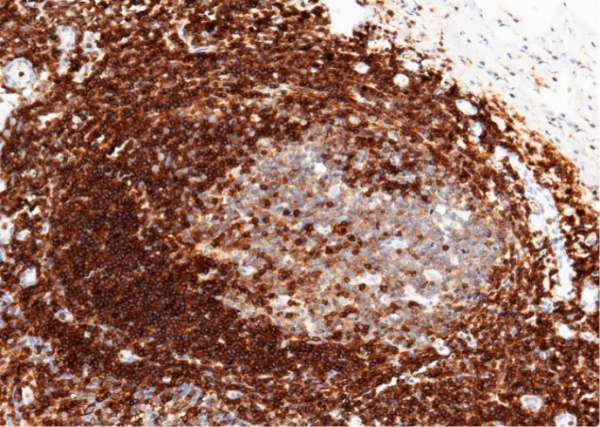 Recombinant CD50/ICAM-3 Monoclonal Antibody (AN300042P)