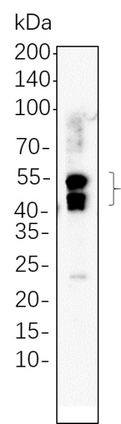 Recombinant LEF1 Monoclonal Antibody (AN300698L)