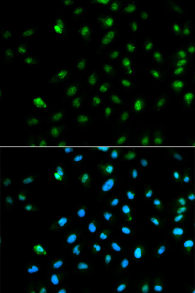 POLR2A Polyclonal Antibody (E-AB-60611)