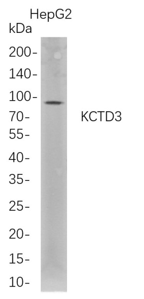 Recombinant KCTD3 Monoclonal Antibody (AN300756L)
