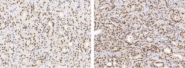 USP7/HAUSP Monoclonal Antibody (AN200056P)