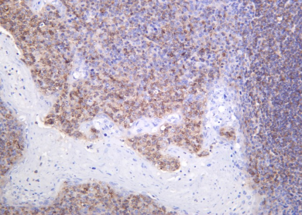Recombinant AIM2 Monoclonal Antibody (AN301278L)