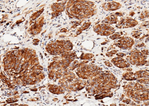 CD63 Monoclonal Antibody (AN200006P)