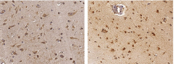 Recombinant NGF/NGFB Monoclonal Antibody (AN300217P)