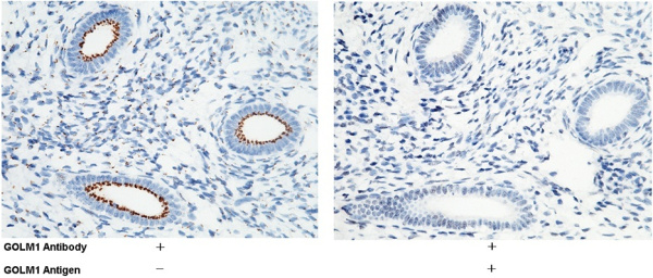 Recombinant GOLM1/GP73 Monoclonal Antibody (AN300431P)