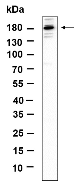 Recombinant TIAM2 Monoclonal Antibody (AN301223L)