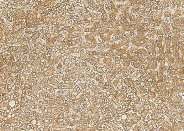 Recombinant Biotinidase/biotinase/BTD Monoclonal Antibody (AN300284P)