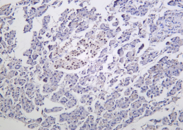 Recombinant Islet-1 Monoclonal Antibody (AN301293L)