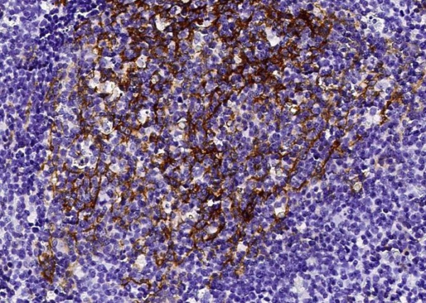 Recombinant CD23/FCER2 Monoclonal Antibody (AN300311P)