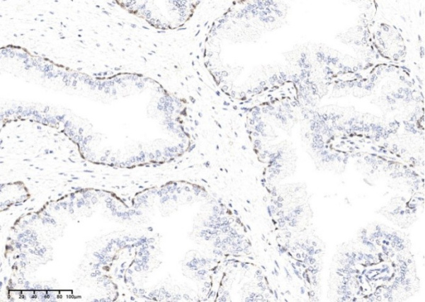 KLK15 Monoclonal Antibody (AN200129P)