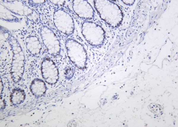 Recombinant MCM2 Monoclonal Antibody (AN301274L)