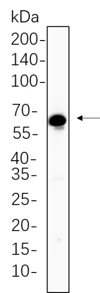 Recombinant TGF β Receptor II Monoclonal Antibody (AN301373L)