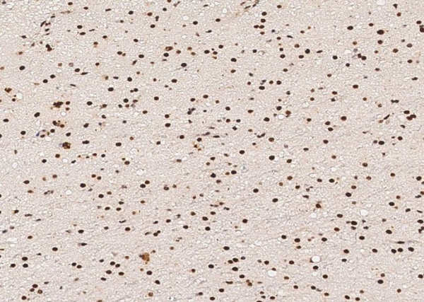 p38 alpha/MAPK14 Monoclonal Antibody (AN200164P)