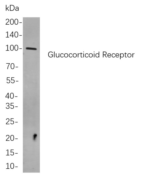 Recombinant Glucocorticoid Receptor Monoclonal Antibody (AN301002L)