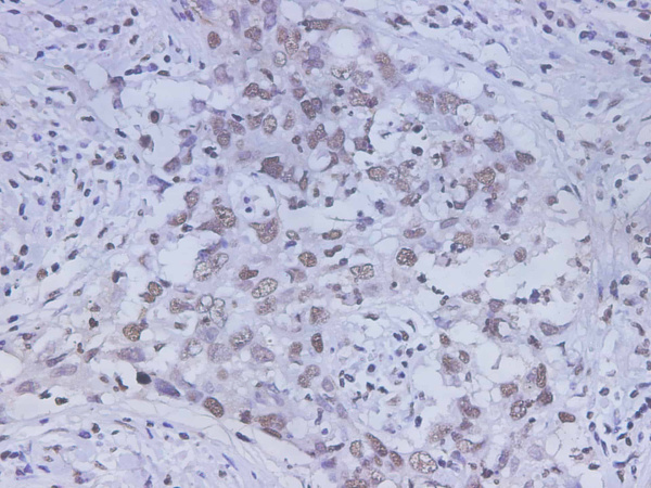 HMGB-1 Polyclonal Antibody (D-AB-10375L)