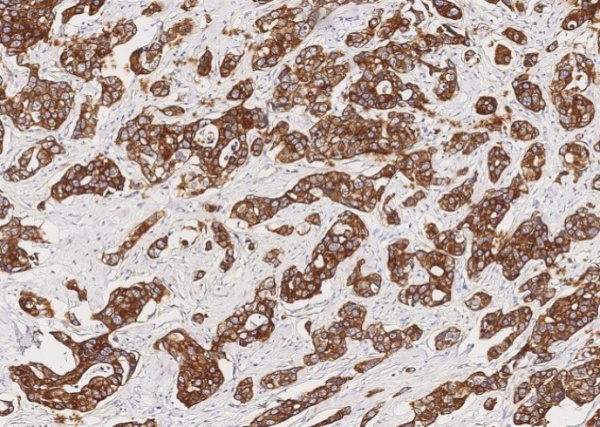 KRT7/ Cytokeratin-7 Monoclonal Antibody (AN200052P)